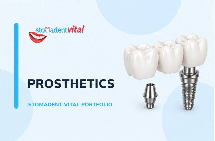 Prosthetics