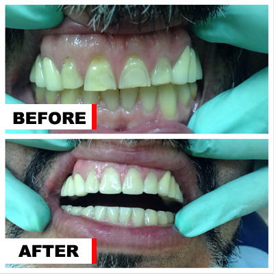 Dental pathology before and after