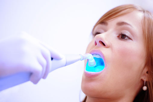 Laser teeth whitening treatment